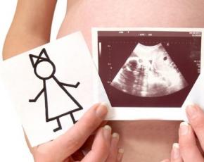 أي نوع من الأشخاص وأي نوع من الاستلقاء ليصبح طفلاً محتملاً عند الحمل: نوع الشخصية، رجل أم امرأة؟